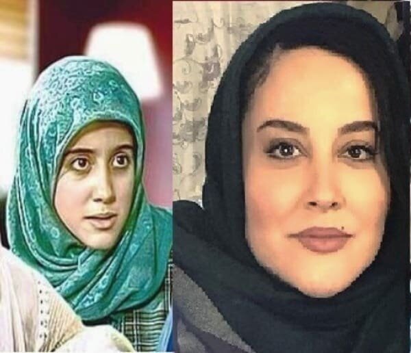 تفاوت عجیب چهره خانم بازیگر قبل از عمل جراحی