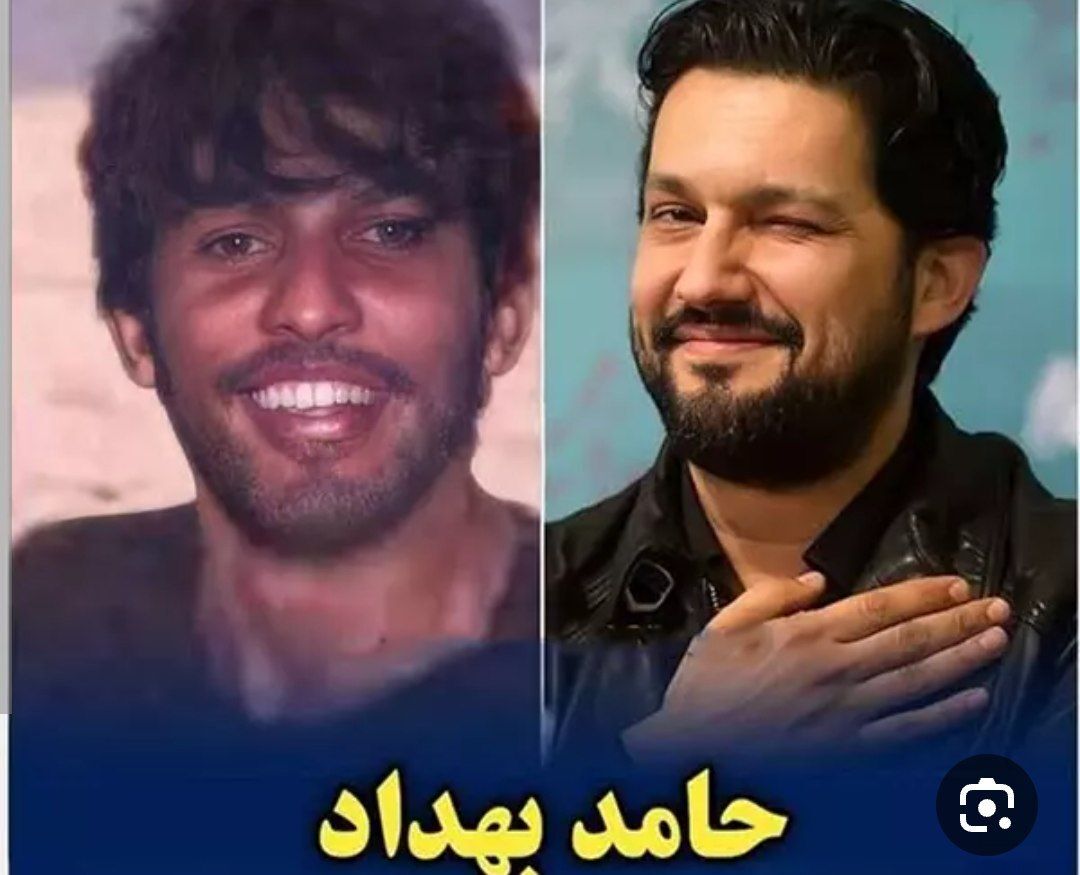 عکس قدیمی و لو رفته از حامد بهداد