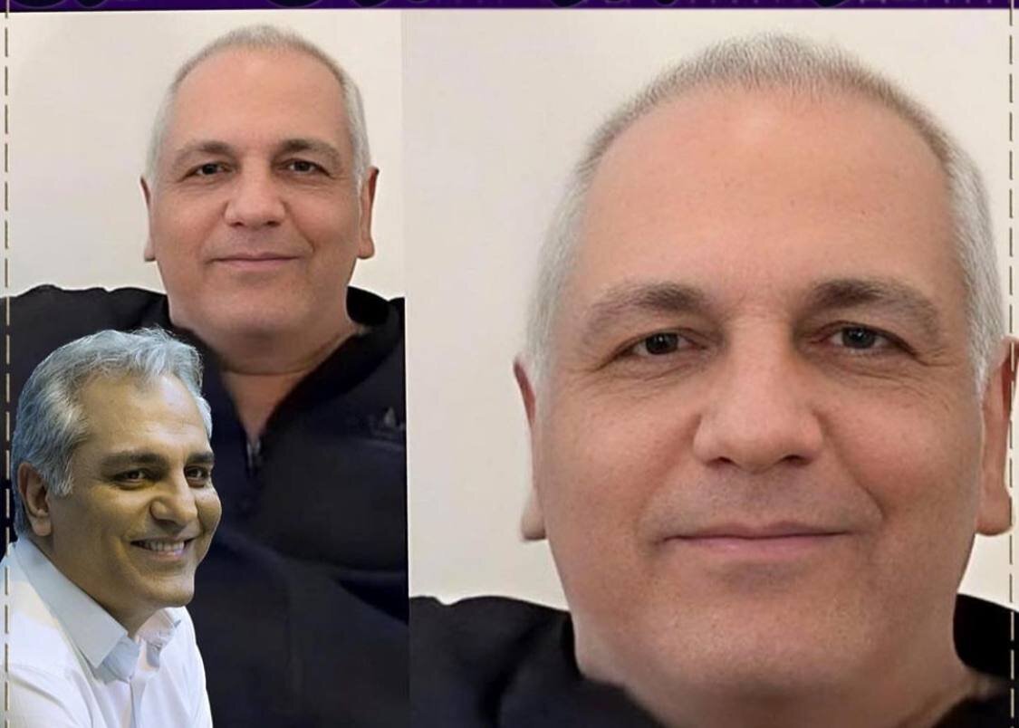 عکس| تصویر خبرساز از مهران مدیری؛ آقای بازیگر موهایش را کامل کوتاه کرد!