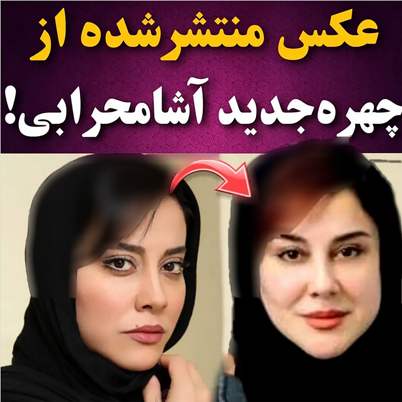 عکس چهره جدید آشا محرابی با چهره جدید