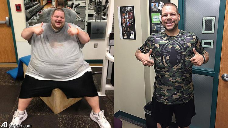 مردی پس از 180 کیلو کاهش وزن +عکس
