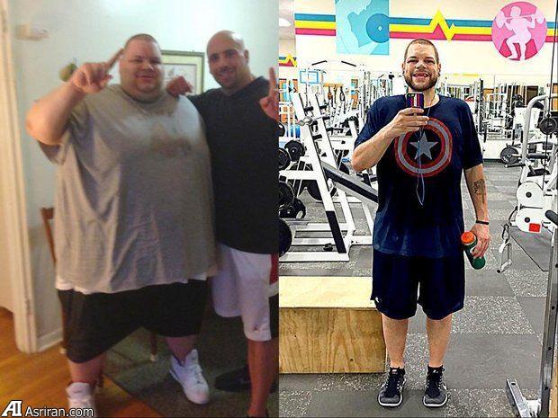 مردی پس از 180 کیلو کاهش وزن +عکس