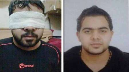 یک زندانی سیاسی بحرینی در اثر سهل انگاری مقامات زندان نابینا شد+عکس