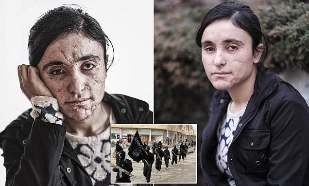 روایت دختر شجاع ایزدی که برای رهایی از چنگال داعشی ها زیبایی خود را منفجر کرد