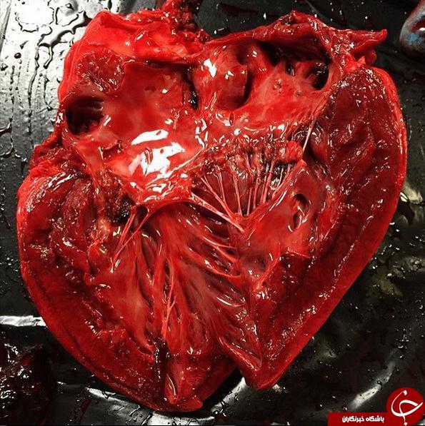 قلب بعد از مردن چه شکلی است؟ +تصاویر
