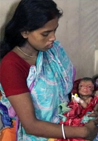 تولد نوزاد ۸۰ ساله در بنگلادش +تصاویر