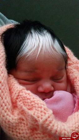 عکس/ نوزادی با موهای سفید