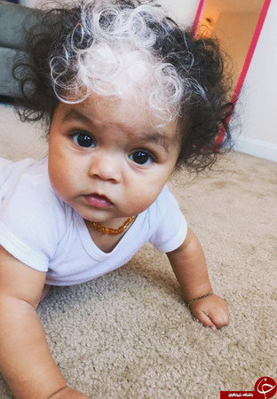 عکس/ نوزادی با موهای سفید