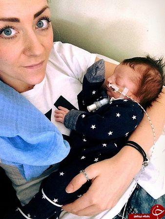 این نوزاد پس از تولد مادرش را به وحشت انداخت +تصاویر