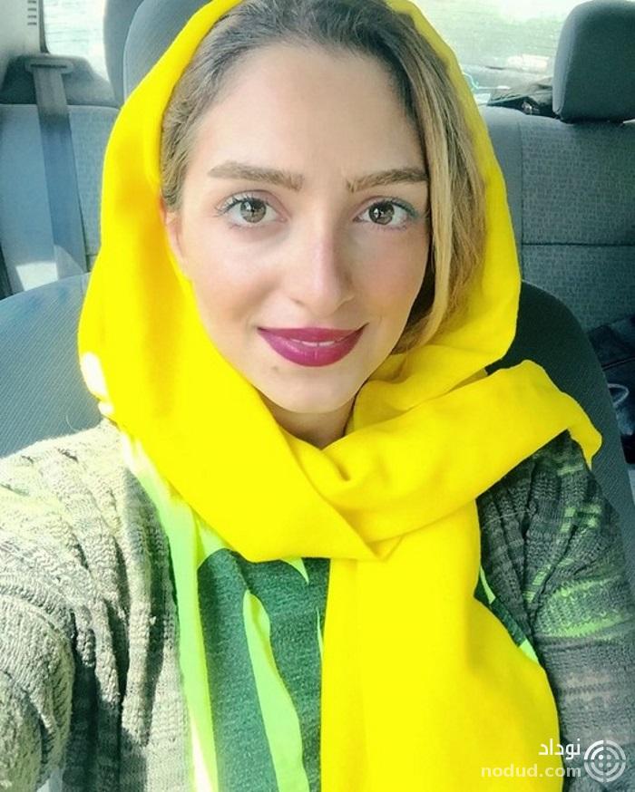 بلایی که خانم بازیگر مشهور ایرانی سر چهره زیبای خود آورد ! + عکس ها