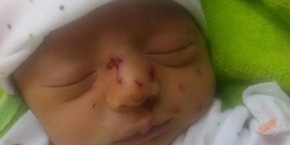 موش گزیدگی نوزاد در بیمارستان اهواز! +عکس