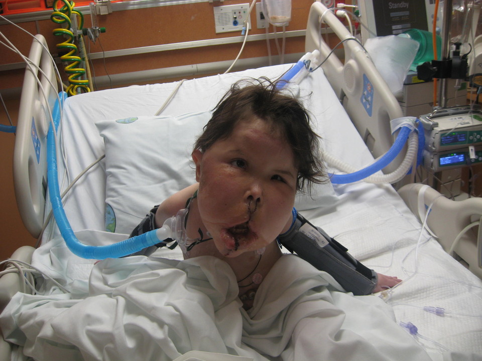 بیماری عجیب دختر ۹ ساله + عکس