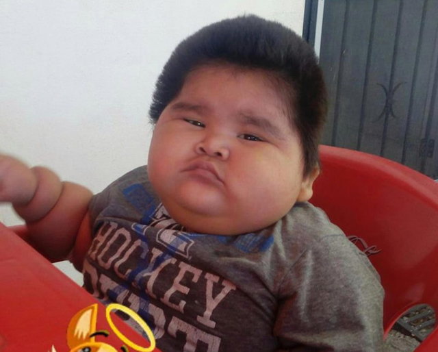 کودک ۱۰ ماهه مکزیکی با ۳۰ کیلو وزن +عکس