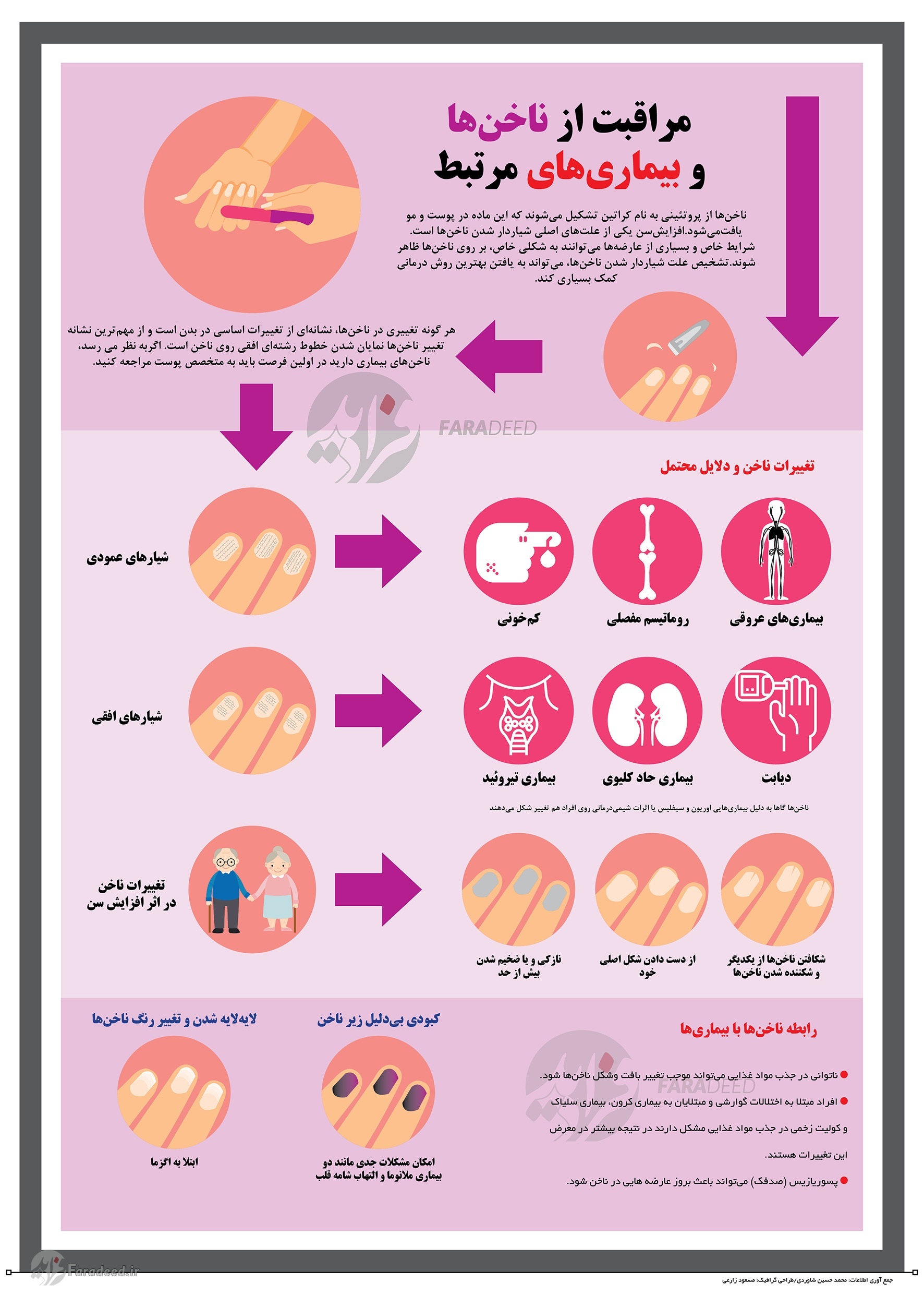 اینفوگرافی/ تشخیص بیماری از روی ناخن