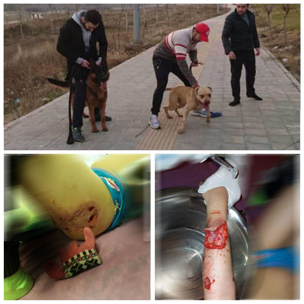 حمله وحشیانه سگ‌ها به یک دختربچه در پارک لواسان +عکس