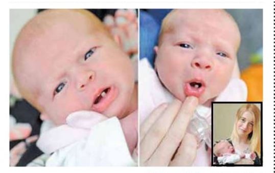 نوزادی که با یک دندان متولد شد!+عکس