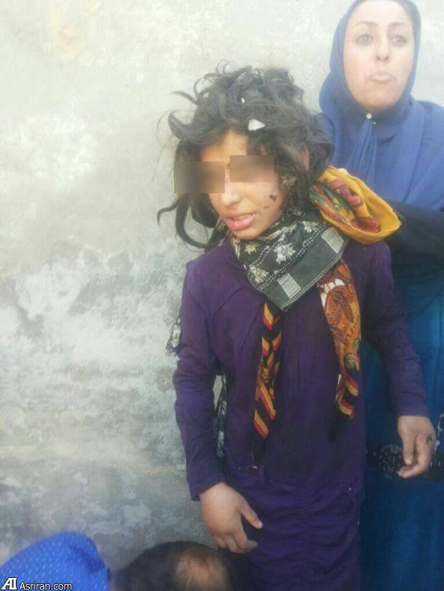 جزئیات شکنجه 3 کودک در ماهشهر با چکش و میله داغ / شکستگی بدن و دندان ها / پدر بازداشت شد (+عکس و فیلم)