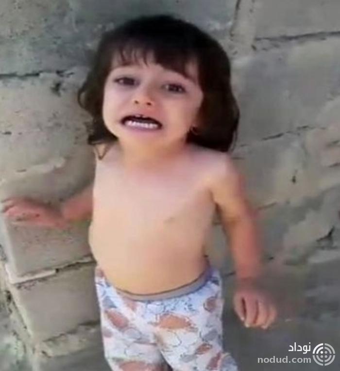 جزئیات شکنجه دختر ۳ ساله توسط پدرش +عکس