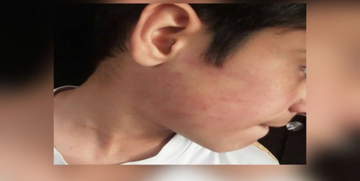 ماجرای تنبیه بدنی شدید یک دانش‌آموز توسط مدیر مدرسه