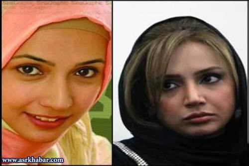 تفاوت چهره بازیگران زن ایرانی، قبل و بعد از عمل زیبایی /تصاویر
