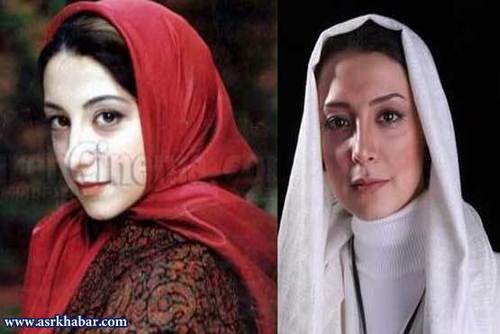 تفاوت چهره بازیگران زن ایرانی، قبل و بعد از عمل زیبایی /تصاویر