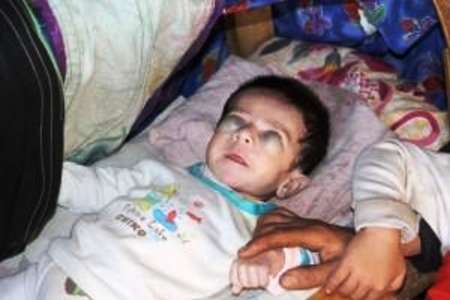 کودک نابینای دهدزی به دستور وزیربهداشت برای درمان به تهران اعزام شد+تصویر