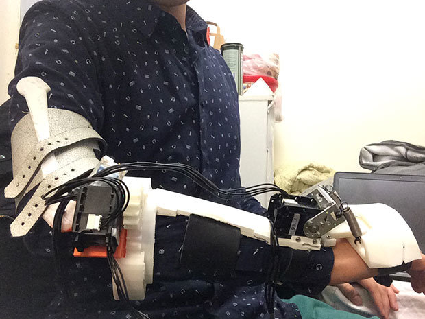 اصلاح مشکلات حرکتی بیماران پارکینسونی با اسکلت هوشمند