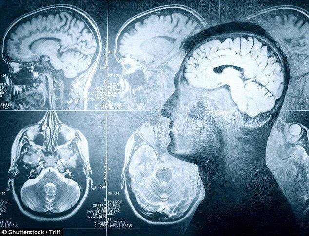 احتمال بازگشت به زندگی تا 5 دقیقه پس از مرگ