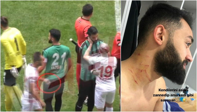 چاقوکشی یک بازیکن در لیگ فوتبال ترکیه