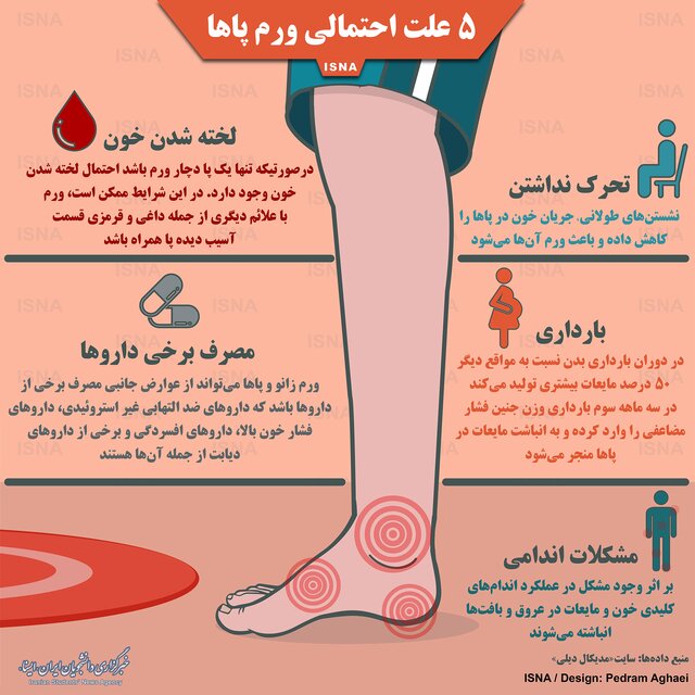 اینفوگرافی / پنج علت احتمالی ورم پاها