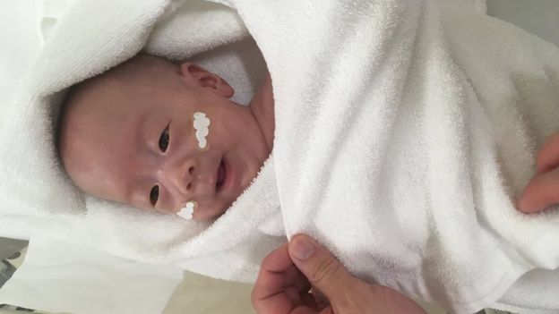کوچک‌ترین نوزاد پسر دنیا از بیمارستان مرخص شد+عکس