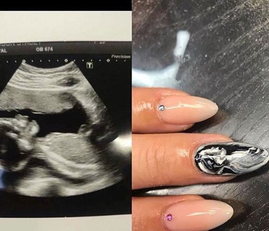 چاپ عکس «جنین» روی ناخن مادران ! +عکس