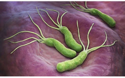 میکروب معده بیماری عفونی، قابل انتقال به دیگران