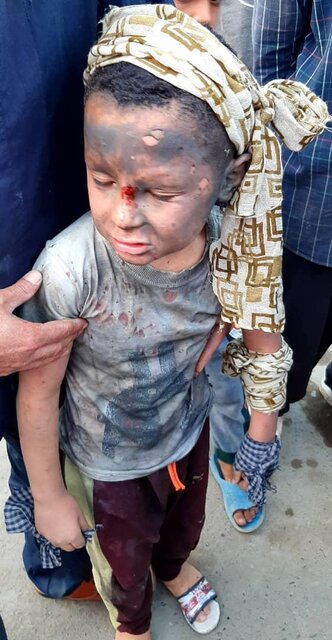 قربانیان چهارشنبهسوری کرونایی؛ حدود ۸۰۰ زخمی و ۲ کشته قربانیان چهارشنبهسوری کرونایی؛ حدود ۸۰۰ زخمی و ۲ کشته