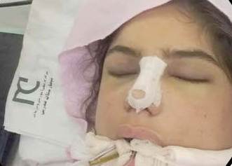 دختر18ساله تهرانی همزمان با جراحی بینی،مرگ مغزی شد + تصاویر