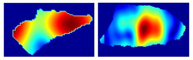 تشخیص سریع سرطان پوست با کمک یک ابزار دستی+عکس
