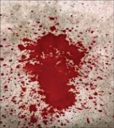 ماجرای زهر چشم خونبار از داماد +عکس ماجرای زهر چشم خونبار از داماد +عکس