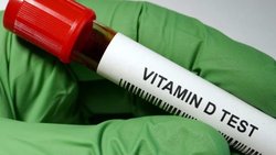 تاثیر کمبود ویتامین D بر التهاب مفصلیِ شایع در کودکان