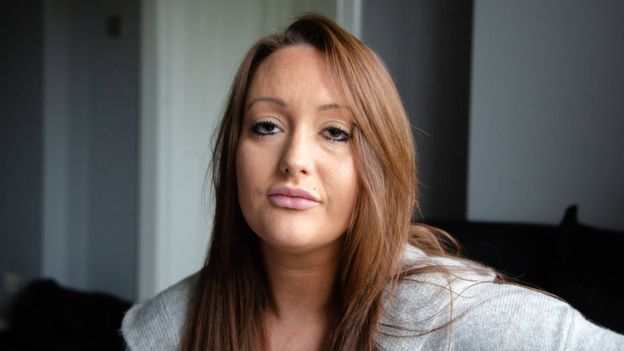 جراحی زیبایی خراب شد، دکترم فرار کرد+عکس