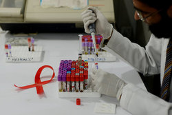 شناسایی 790 مبتلا به ایدز در خراسان رضوی