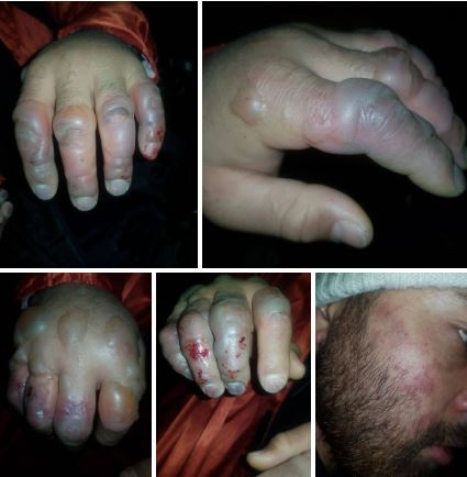 جمعه سیاه کوهنوردی به خاطر اختلال در GPS اتفاق افتاد؟