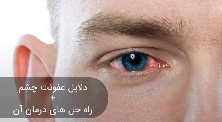 دلیل عفونت چشم چیست؟ و روش‌های درمان آن