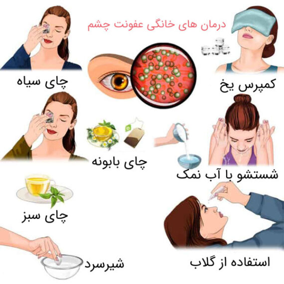 دلیل عفونت چشم چیست؟ و روش‌های درمان آن