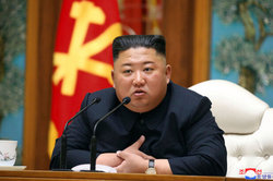 مقام آمریکایی: حال جسمانی رهبر کره‌شمالی در وضعیت خطرناکی است