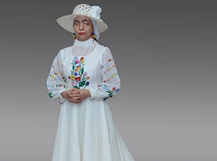 زنان قربانی اسیدپاشی مدل لباس شدند