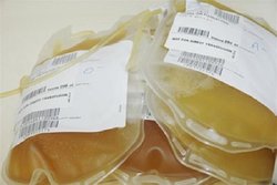 نیاز کلانشهرها به پلاسمای بهبودیافتگان کرونا / درخواست اهدای خون همه گروه‌های خونی