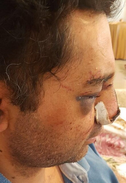 عکس| ضرب و شتم شدید یک متخصص بیهوشی توسط همراهان یک بیمار در پیرانشهر