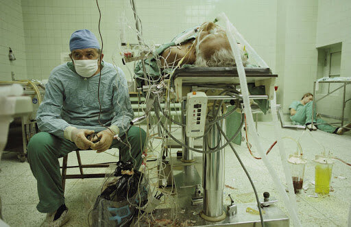 عکسی تکان دهنده از اولین عمل جراحی قلب