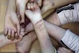 آسیب عمدی به خود یکی از رفتارهای پر خطر دانشجویان/مرگ سالانه 800 هزار نفر بر اثر خودکشی