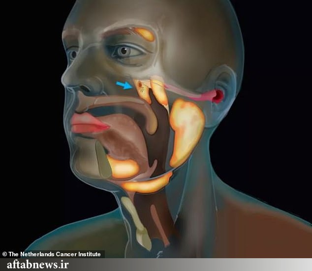 عکس| کشف اندام تازه در گلوی انسان